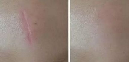 楊嫻嫻整形醫(yī)生技術與實力揭秘