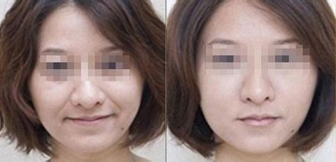 成都有哪些專業(yè)的雙眼皮整形醫(yī)生值得推薦？