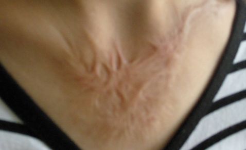 杭州著名雙眼皮醫(yī)生推薦，高口碑為你揭曉