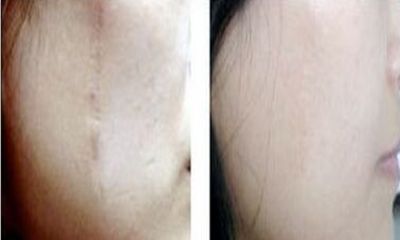 合肥專業(yè)磨骨手術(shù)醫(yī)院：醫(yī)術(shù)精湛，信譽(yù)有保障！