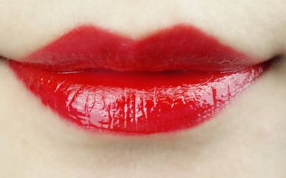 南京的施爾美整形醫(yī)院，讓孫欣恢復(fù)明亮清澈的雙眸