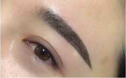 玻尿酸注射之美——揭秘填充術(shù)的多重優(yōu)勢