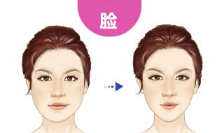 衡陽附二可信度高的雙眼皮手術(shù)醫(yī)生與案例分享