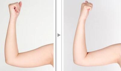 北京新星靚醫(yī)療美容醫(yī)院真的靠譜嗎？李偉民醫(yī)生的資料是怎樣的？