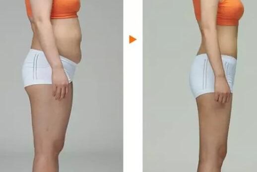 上海下頜角整形領(lǐng)先醫(yī)院揭曉！這三家醫(yī)院有華美、美聯(lián)臣與伊萊美！