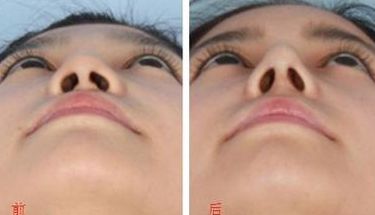 無錫市更受歡迎的吸脂醫(yī)院排行榜2023！這3家醫(yī)院赫然在列