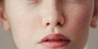 鼻子雕塑：探索華美高順福的鼻部變革效果與實(shí)例分享