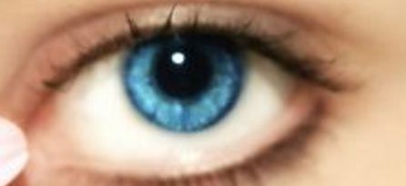 重醫(yī)附一院楊娥_這項(xiàng)技術(shù)為去眼袋法的真人案例值得一看！