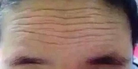 北京整形美容領域醫(yī)院推薦！最受好評的隆鼻醫(yī)院新版名單發(fā)布！