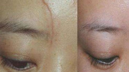 西京醫(yī)院美容科的醫(yī)師團隊與隆鼻優(yōu)質服務如何？