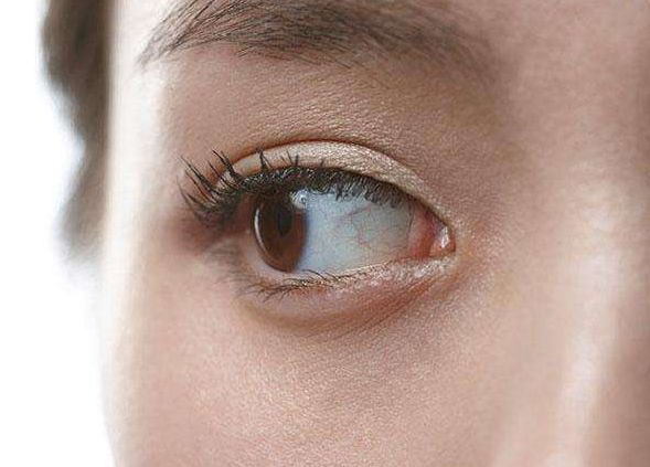 蘇州余道江隆鼻醫(yī)院費用如何？快來看看效果圖選擇參考