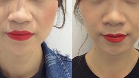 2023年熱議：揭秘重慶市當(dāng)?shù)貥O具口碑的整容醫(yī)院！