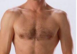 成都整容醫(yī)生吳開泉鼻部整形手術(shù)真實案例！