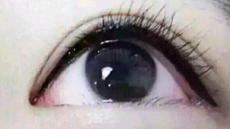 深圳哪家醫(yī)院割雙眼皮效果更好？值得推薦！