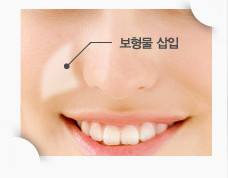 廣州韓后醫(yī)療美容門診部真的靠譜嗎？值得信賴嗎？他們擅長哪些整形項目？技術水平如何？