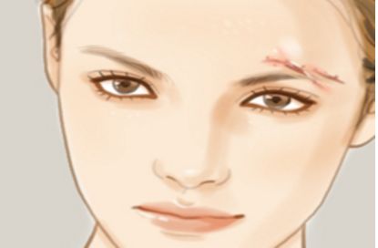 昆明熱瑪吉手術(shù)合格專(zhuān)家醫(yī)院匯總，想知道的小伙伴記得收藏！