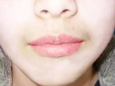 無錫三院整形科哪位醫(yī)生會(huì)更受關(guān)注？