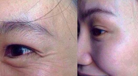 北京空軍總醫(yī)院優(yōu)秀整形美容專家推薦，4位公認(rèn)人氣高！