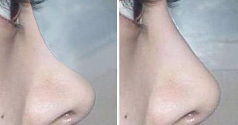 無錫最新醫(yī)美熱門！高人氣整形醫(yī)院揭秘，信譽在線！