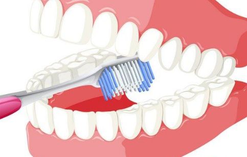 獨特魅力之李映雨隆胸歷程，魔法技藝完美呈現