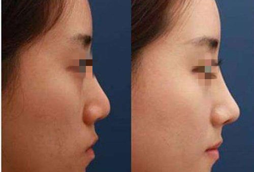 重慶愛思特整形美容醫(yī)院團隊的技術一覽，值得信賴嗎？