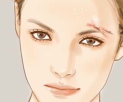 哪家醫(yī)院是國(guó)內(nèi)顴骨整形的佼佼者？九院，華西，西京等整友們贊不絕口！