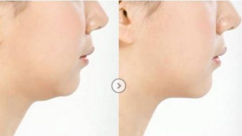 無(wú)錫哪家整形醫(yī)院正規(guī)靠譜？2023曼陀羅、伊爾美等名院是首選！