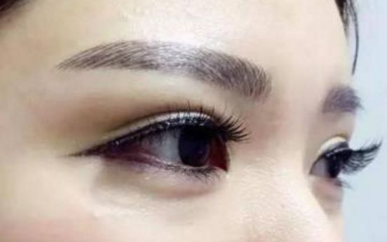 2023年最受認可的國內(nèi)拉皮手術(shù)醫(yī)生排行榜，頂尖專家名單公布