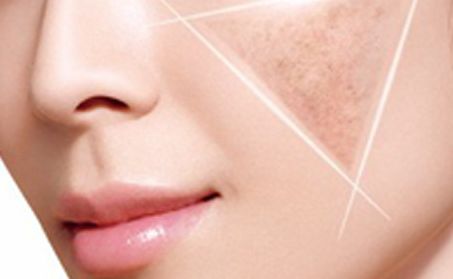 卿勇隆鼻效果如何？專家所屬醫(yī)院披露