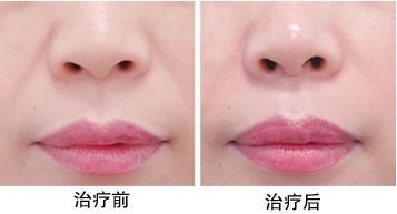 南充最受認(rèn)可的整形醫(yī)院排行出爐！TOP6機(jī)構(gòu)實(shí)力超強(qiáng)，點(diǎn)評(píng)不容錯(cuò)過！技術(shù)贊譽(yù)度扶搖直上！