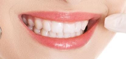 2023年一覽廈門最新雙眼皮醫(yī)療機(jī)構(gòu)-替代列表中，星系、顏王等上榜，自主選擇美容服務(wù)！