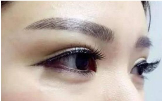 經(jīng)驗(yàn)豐富！華西地區(qū)雙眼皮重點(diǎn)醫(yī)生推薦，名單揭秘！