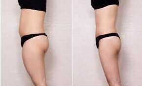 揭曉！揭秘武漢市最出色的肋鼻治療醫(yī)生榜單TOP5