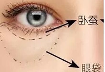 北京協(xié)和醫(yī)院隆胸案例與醫(yī)生簡介含金量如何？收費是否合理？