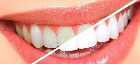 成都蔡震醫(yī)生隆鼻手術(shù)案例及費(fèi)用解析