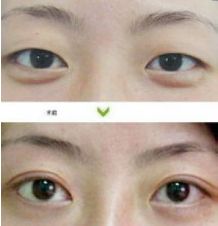 成都哪些醫(yī)生能力出眾進(jìn)行隆胸術(shù)？年度隆胸好醫(yī)生十大排名出爐