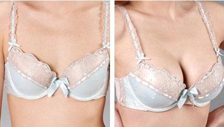 深圳的雙眼皮整形醫(yī)院排行榜2023年最新發(fā)布