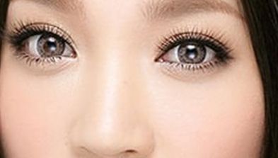 上海張余光醫(yī)生的鼻子整形，贏得大眾好評