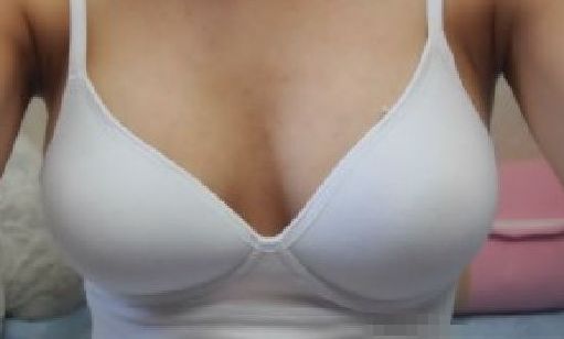 天后朱東磊鼻子整形效果如何？專(zhuān)家評(píng)估結(jié)果公開(kāi)解析