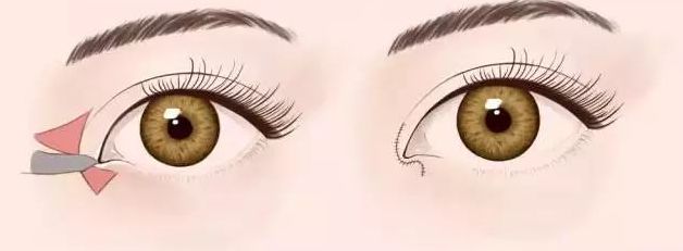 2023年福州整形醫(yī)院預(yù)計將迎來新的變革！