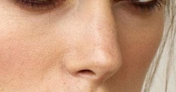 西安哪家醫(yī)院治療雙眼皮效果專業(yè)？達(dá)人推薦，好口碑！