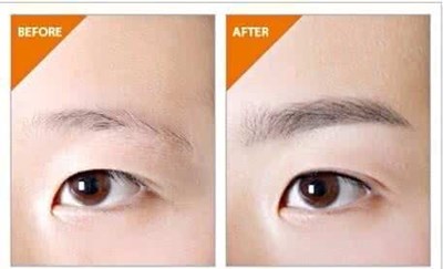 華西醫(yī)院整形外科靠譜嗎？手術(shù)費用和?？凭ǖ目剖矣心男?？