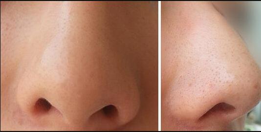 上海九院整形科怎么掛號(hào)預(yù)約？只需簡(jiǎn)單幾步，輕松解決！