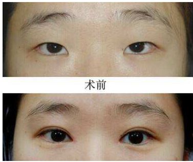 成都比較好的雙眼皮整形醫(yī)院推薦  七家熱門整容醫(yī)院名單展示