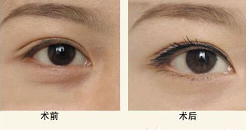 【獨(dú)家】上海九院整形科醫(yī)生王琛醫(yī)生的專(zhuān)長(zhǎng)與案例分享