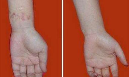 重慶暢美吸脂減肥醫(yī)院：革新技術(shù)引領(lǐng)行業(yè)，成就完美曲線