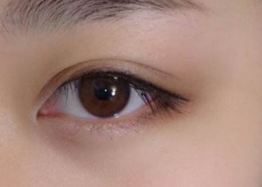 重慶2023年雙眼皮醫(yī)生：吳小樓、曹陽、何勝旗醫(yī)術(shù)對比