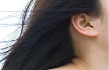 切眉后消腫需要多久才能恢復正常？需要注意哪些事項來促進消腫？