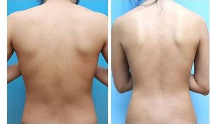 2023年長(zhǎng)沙地區(qū)推薦的面部拉皮除皺醫(yī)生排行榜公開(kāi)醫(yī)生背景介紹詳細(xì)版