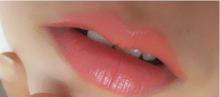 秦皇島頂級(jí)醫(yī)院一次雙眼皮手術(shù)價(jià)格揭秘，專家推薦+真實(shí)案例告訴你！